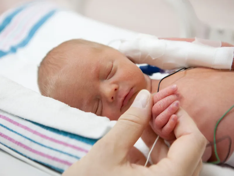 Neonatal NICU Baby