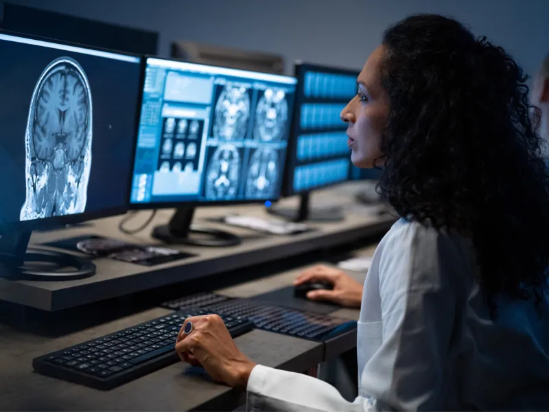 Doctor looking at a brain CT scan.