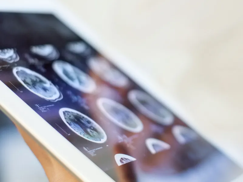 Brain scans displayed on a tablet